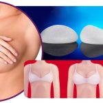 Prótese de Silicone: como escolher o melhor formato e volume para cada paciente