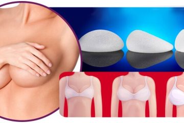 Prótese de Silicone: como escolher o melhor formato e volume para cada paciente
